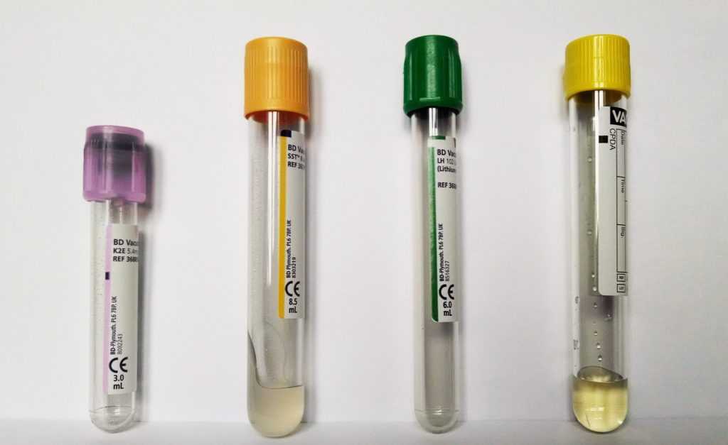 Information on the collection of test material - Laboratory tests in Europe