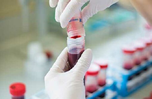 Borrelia EliSpot - Image 3