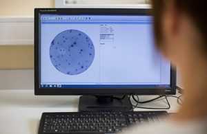 Elispot Lyme coinfections result reader