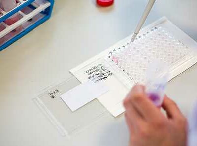 Borrelia miyamotoi EliSpot