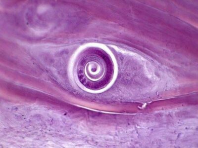 Parasitic infections